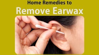 Home Remedies to Remove Earwax  Hydrogen Peroxide amp Baking Soda [upl. by Ekaterina915]