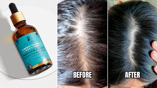 Pilgrim Redensyl amp Anagain Hair Serum For Hair Regrowth  Price Results Ingredients How To Apply [upl. by Llevra]