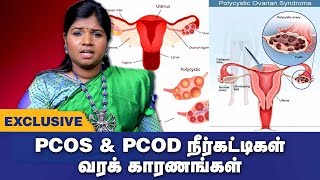 PCOD amp PCOS Symptoms amp Treatment in Tamil  PCOD amp PCOS Siddha Treatment  Tamil health tips [upl. by Anauj]