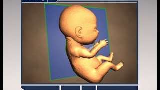 Step by Step to Get Perfect 3D4D Baby Image [upl. by Syst]