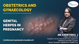 Obstetrics and Gynaecology  Genital herpes in pregnancy  Raaonline [upl. by Imeaj]