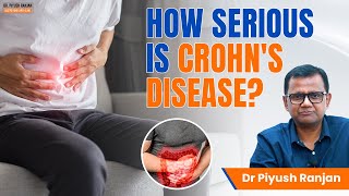 Mayo Clinic Explains Crohn’s Disease [upl. by Mercy67]