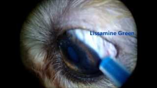 Nasolacrimal duct flush Lissamine green trick [upl. by Rowland]