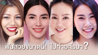 อยากฟันสวย ปัง ขนาดนี้ มาดูว่า แต่ละคนทำฟันอะไรบ้าง  COSDENT SMILE DESIGN [upl. by Acihsay]