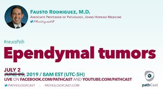 Ependymal tumors  Dr Rodriguez Hopkins NEUROPATH [upl. by Akeret]