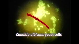 Candida albicans under Fluorescence microscope stained with Acridine Orange [upl. by Onfroi607]