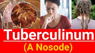 Tuberculinum homeopathic medicine  Learn which of lung is involved in different medicines [upl. by Can]