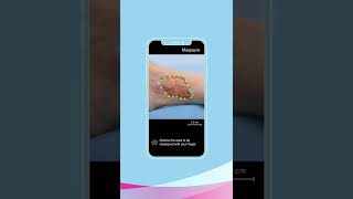 Cutimed Wound Navigator Your smart app for individual wound care English [upl. by Fontes]