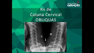 Radiografia da Coluna Cervical  Obliquas [upl. by Nyrroc]