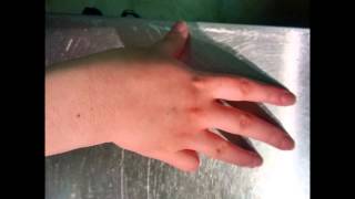 Lateralization Practice  Southlake Hand Therapy [upl. by Radnaxela]