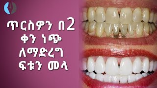 Ethiopia ጥርስዎን በ2 ቀን ነጭ ለማድረግ ፍቱን መላ  Whiten Teeth With Two Days [upl. by Nitsuga]