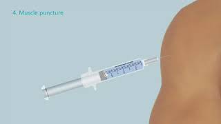 Automatic Retractable Safety Syringe wwwpnmedicalcom [upl. by Alset226]