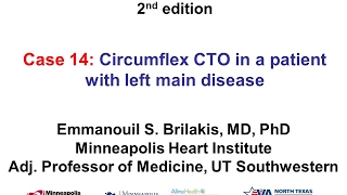 Case 14 Manual of CTO Interventions  Circumflex CTO in a patient with left main disease [upl. by Kinnard]