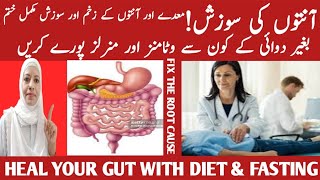 How To Improve Gut Health And Digestion Best And Worst Foods For Gut Health Listen Your Body [upl. by Sydel898]