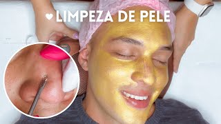 LIMPEZA de PELE PREMIUM profissional  com peeling químico [upl. by Lala]