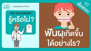 ฟันผุเกิดขึ้นได้อย่างไร  คุณหมอฝากมา Ep43 COSDENT SMILE DESIGN [upl. by Handler748]