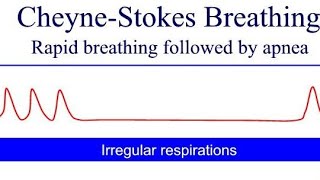 Cheyne Stokes Breathing Pattern  general diseases in human body Cheyne Stokes Kussmauls Biots [upl. by Sky]