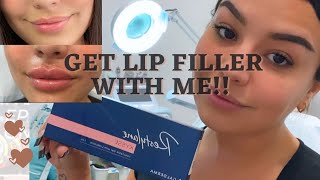 Restylane Kysse Lip Filler Vlog  Sylvia Ruback [upl. by Hosfmann]