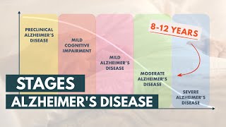 Stages and Life Expectancy of Alzheimers Disease [upl. by Tomlin]