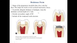 Operative Dentistry Lec 4 Cavity preparation of Cl 1 for amalgam restorations [upl. by Ettevy]