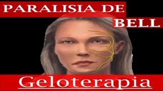 Geloterapia e exercícios para paralisia de BELL [upl. by Noemi]