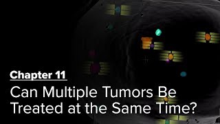 Can Multiple Tumors Be Treated at the Same Time Chapter 11 — Brain Metastases A Documentary [upl. by Mcquillin]