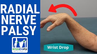 Radial Nerve Palsy Wrist Drop Evaluation [upl. by Wengert929]