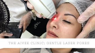 GENTLE LASER PORES AT THE AIVEE CLINIC  Cat ArambuloAntonio [upl. by Prouty]