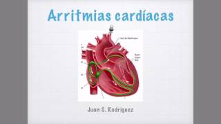 Arritmias cardíacas en el EKG [upl. by Aamsa360]