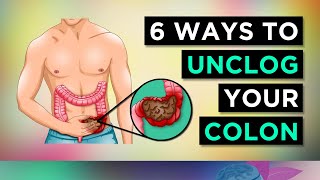 6 Ways To CLEAR Your CONSTIPATION [upl. by Heller]