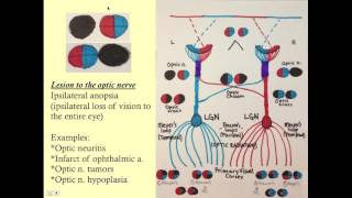 Neuroopthalmology  CRASH Medical Review Series [upl. by Eissej538]