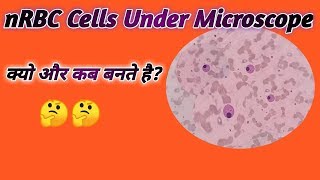 How to make nRBC  Nucleated cells on slide  nRBC under microscope [upl. by Behrens471]