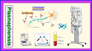 plasmapheresis [upl. by Suoicul]