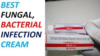 Candiderma Cream Review  BEST Cream FOR Infections [upl. by Magbie]