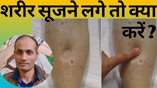 Homeopathic Medicine Curcuma longa  हर तरह की बीमारी से आपको बचाए  Symptoms  How to use [upl. by Loos]