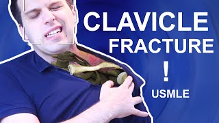 Clavicle Fracture  Recovery and Dangerous Complications USMLE 1 [upl. by Tibold136]