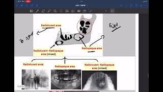 introduction of oral pathology part 4 [upl. by Inirt]