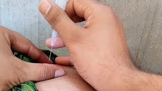 लड़की को लगाया हार्मोनल इंजेक्शन ll hip injection vlog ll buttocks injection vlog ll injection ll [upl. by Holmes470]