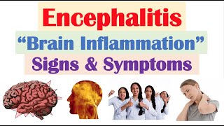 Encephalitis “Brain Inflammation” Signs and Symptoms amp Why They Occur [upl. by Dene]