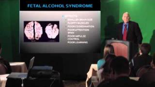 Alcohol amp Fetal Alcohol Syndrome [upl. by Gnourt]