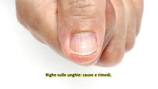 Righe sulle unghie cause e rimedi [upl. by Sari]