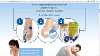 Valgus 2 in 1 Italy  Trattamento dellalluce valgo [upl. by Werd]