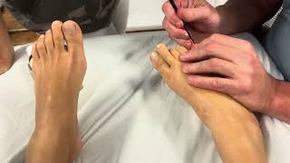 Deep Foot reflexology massage using massage tools for a scoliosis Brandon massaging Faina part 3 [upl. by Annabell]