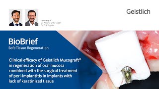 Clinical case Efficacy of Geistlich Mucograft® for lack of keratinized tissue and periimplantitis [upl. by Nibla365]