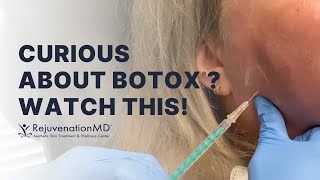 Typical Botox Injections for Master Muscles Glabella and Forehead [upl. by Heise608]