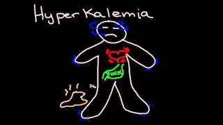 Hyperkalemia [upl. by Gradeigh398]