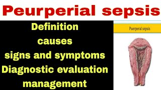 peurperial sepsis Introduction Causes  Signs and Symptoms DE  management [upl. by Conyers547]