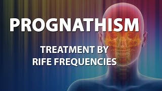 Prognathism  RIFE Frequencies Treatment  Energy amp Quantum Medicine with Bioresonance [upl. by Hanah]