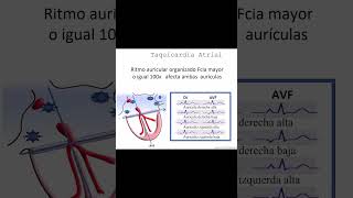 Cómo Tratar Taquicardias Guía Completa  Dr Jose Porto [upl. by Dominique]