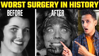 Why is Lobotomy The Worst Surgery In History  The Dark Side Of Science [upl. by Radmen]